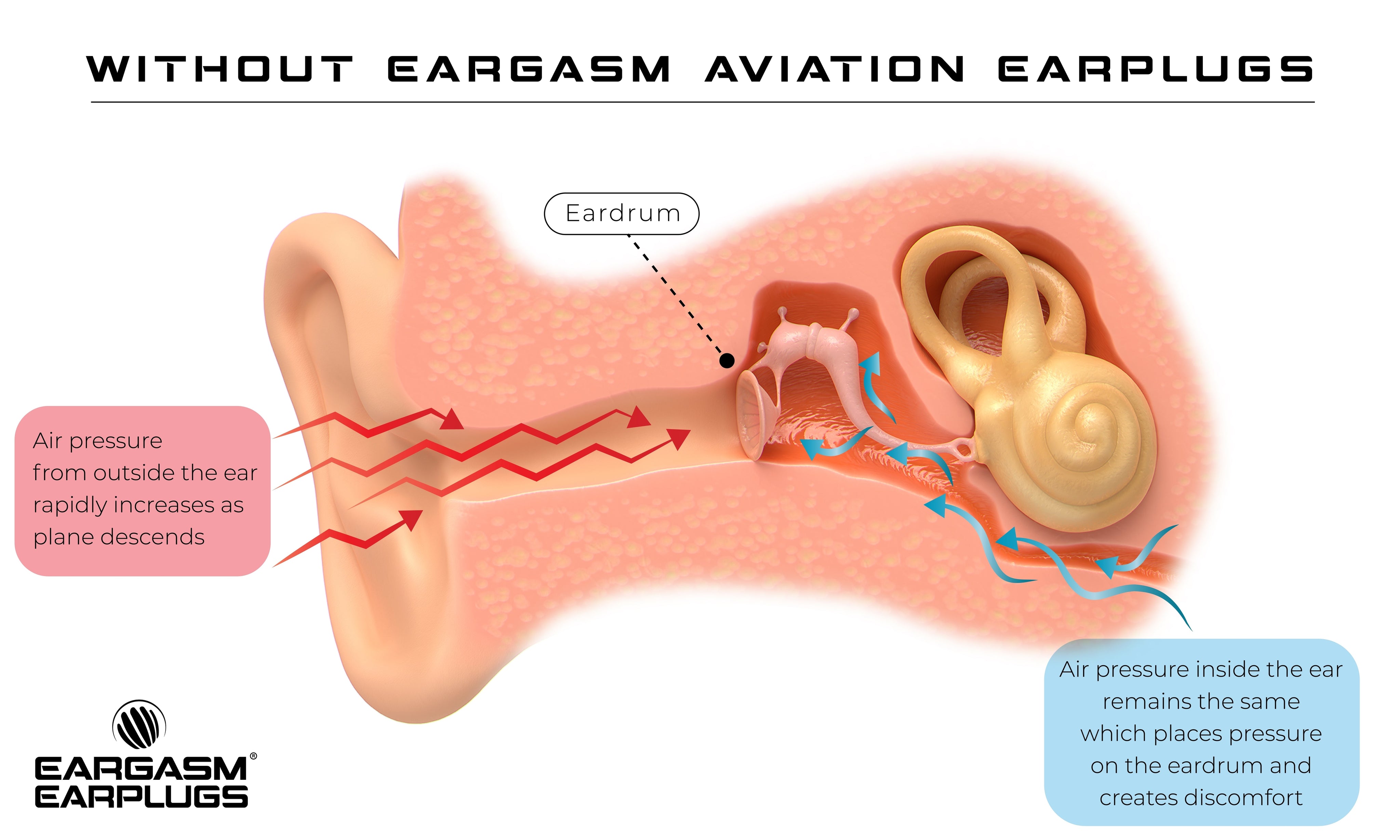 Aviation Earplugs Reduce Ear Pain During Air Travel! Eargasm